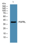 Western blot analysis of lysates from SH-SY5Y cells, primary antibody was diluted at 1:1000, 4°over night