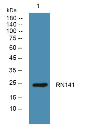 Western blot analysis of lysates from U2OS cells, primary antibody was diluted at 1:1000, 4°over night