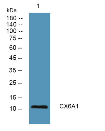 Western blot analysis of lysates from SH-SY5Y cells, primary antibody was diluted at 1:1000, 4°over night