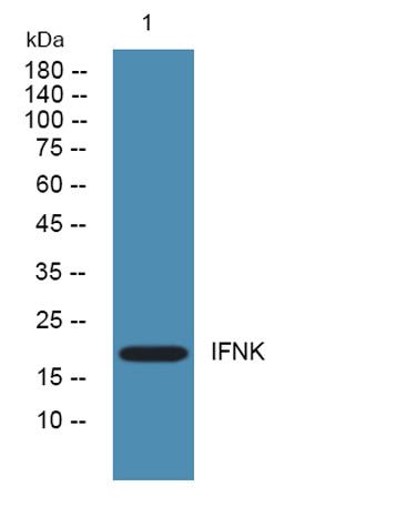 Western blot analysis of lysates from PC12 cells, primary antibody was diluted at 1:1000, 4°over night