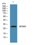 Western blot analysis of lysates from SW480 cells, primary antibody was diluted at 1:1000, 4°over night