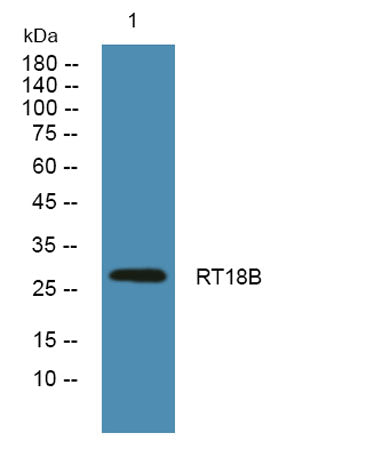 Western blot analysis of lysates from K562 cells, primary antibody was diluted at 1:1000, 4°over night