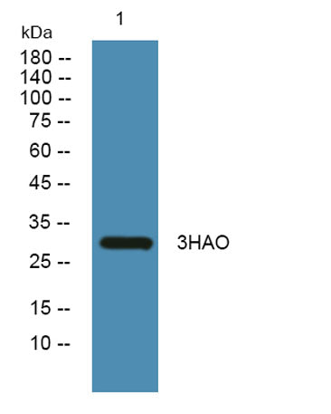 Western blot analysis of lysates from SW480 cells, primary antibody was diluted at 1:1000, 4°over night