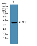 Western blot analysis of lysates from PC12 cells, primary antibody was diluted at 1:1000, 4°over night