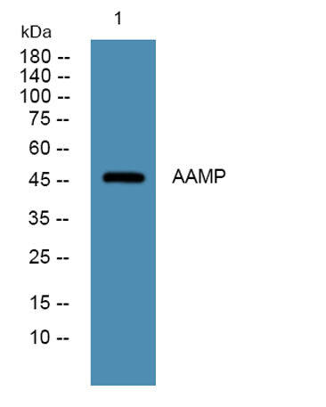 Western blot analysis of lysates from SW480 cells, primary antibody was diluted at 1:1000, 4°over night