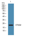 Western blot analysis of lysates from DU145 cells, primary antibody was diluted at 1:1000, 4°over night