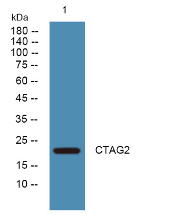Western blot analysis of lysates from DU145 cells, primary antibody was diluted at 1:1000, 4°over night