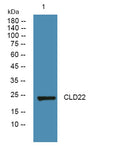 Western blot analysis of lysates from SH-SY5Y cells, primary antibody was diluted at 1:1000, 4°over night