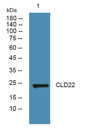 Western blot analysis of lysates from SH-SY5Y cells, primary antibody was diluted at 1:1000, 4°over night