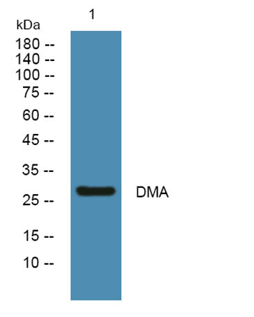 Western blot analysis of lysates from PC12 cells, primary antibody was diluted at 1:1000, 4°over night