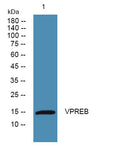 Western blot analysis of lysates from Jarkat cells, primary antibody was diluted at 1:1000, 4°over night