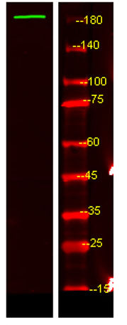 Western Blot analysis of HEK293 lysis, using primary antibody at 1:1000 dilution. Secondary antibody(catalog#:RS23920) was diluted at 1:10000