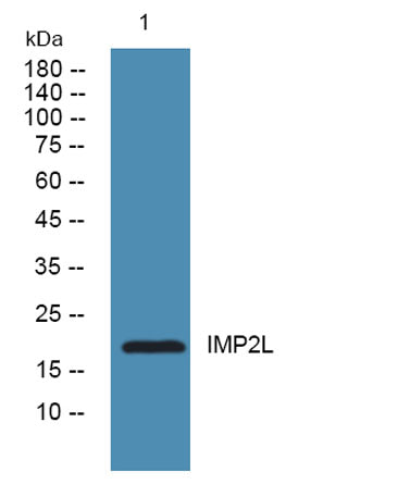Western blot analysis of lysates from Jarkat cells, primary antibody was diluted at 1:1000, 4°over night