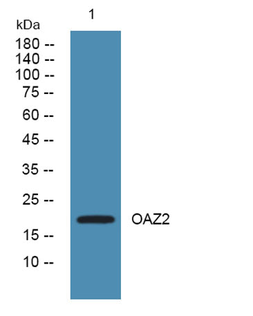 Western blot analysis of lysates from SW480 cells, primary antibody was diluted at 1:1000, 4°over night