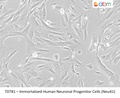 Immortalized Human Neuronal Progenitor Cells (Neu41) | Applied Biological Materials (abm)