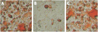 FK-506 – Figure 1 of 2