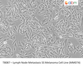 Lymph Node Metastasis SS Melanoma Cell Line (MM074) | Applied Biological Materials (abm)
