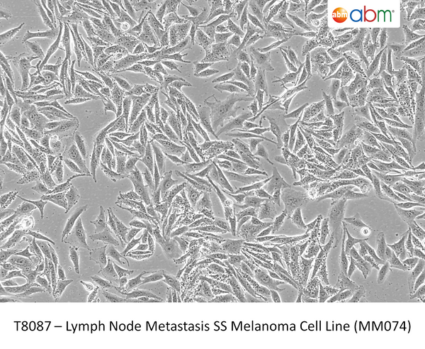 Lymph Node Metastasis SS Melanoma Cell Line (MM074) | Applied Biological Materials (abm)