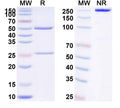 Anti-Human beta-NGF Reference Antibody (Frunevetmab) – Figure 1 of 1
