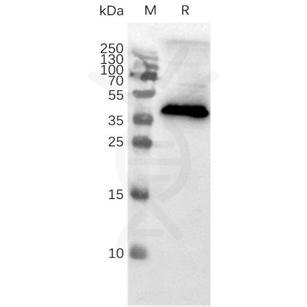 Human CCR8 full length protein-MNP – Figure 1 of 1