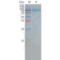 Human SSTR2 full length protein-synthetic nanodisc – Figure 1 of 1