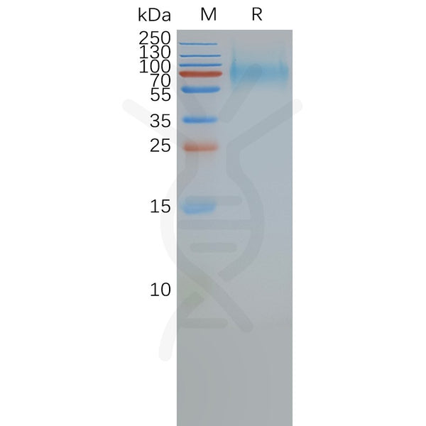 Human SSTR2 full length protein-synthetic nanodisc – Figure 1 of 1