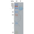 Human ADORA2A full length protein-synthetic nanodisc – Figure 1 of 1
