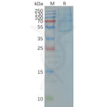 Human CCR4 full length protein-synthetic nanodisc – Figure 1 of 1