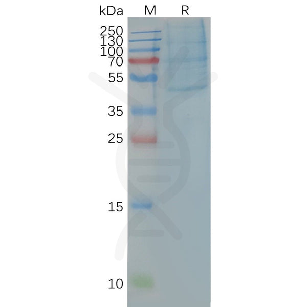 Human CCR4 full length protein-synthetic nanodisc – Figure 1 of 1