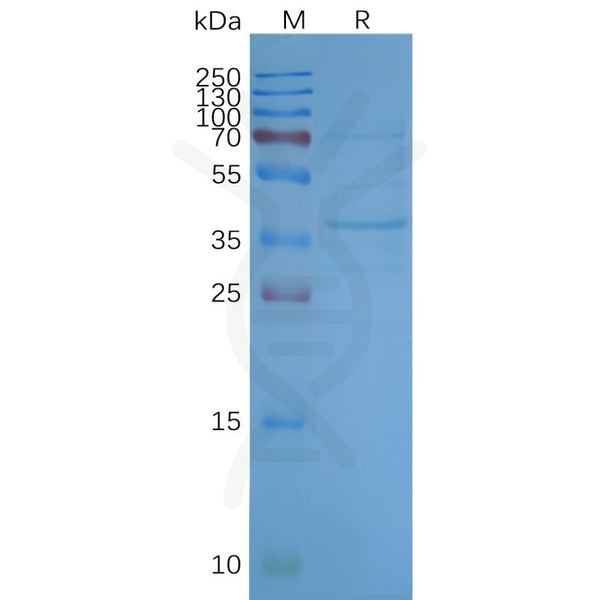 Human OR2H1 full length protein-synthetic nanodisc – Figure 1 of 1
