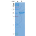 Human CD20 full length protein-synthetic nanodisc – Figure 1 of 1