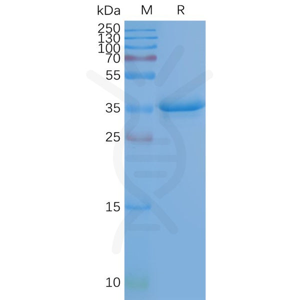 Human CD20 full length protein-synthetic nanodisc – Figure 1 of 1