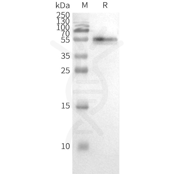 Human CCR2 full length protein-synthetic nanodisc – Figure 1 of 1