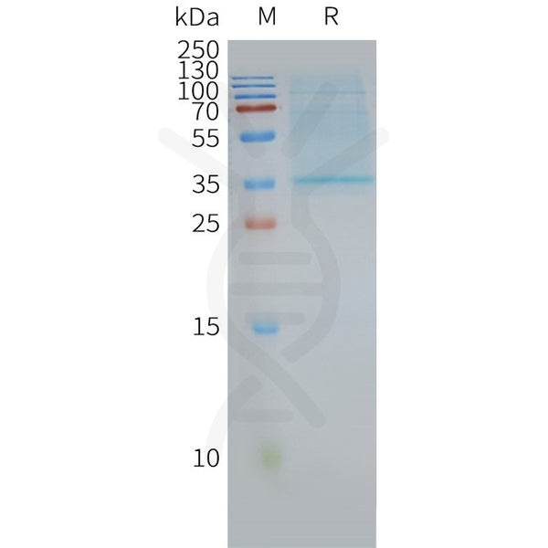 Human CD63 full length protein-synthetic nanodisc – Figure 1 of 1
