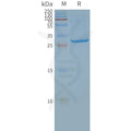 Human SLC25A4 full length protein-synthetic nanodisc – Figure 1 of 1