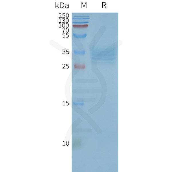 Human TSPAN33 full length protein-synthetic nanodisc – Figure 1 of 1