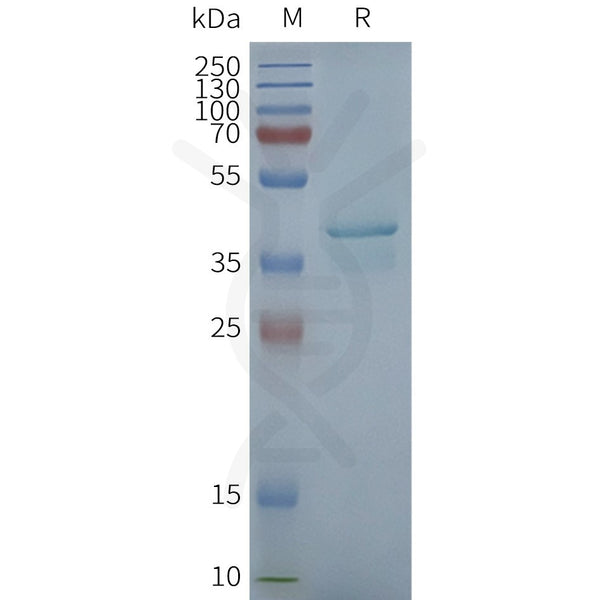 Human STING1 full length protein-synthetic nanodisc – Figure 1 of 1