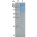 Human CD37 full length protein-synthetic nanodisc – Figure 1 of 1