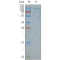 Human TSHR full length protein-synthetic nanodisc – Figure 1 of 1