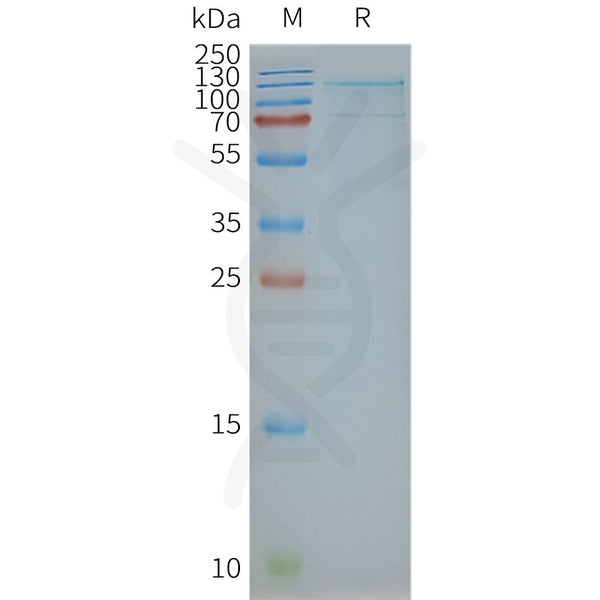 Human TSHR full length protein-synthetic nanodisc – Figure 1 of 1