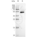 Human CXCR3 full length protein-synthetic nanodisc – Figure 1 of 1