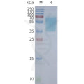 Human GPR55 full length protein-synthetic nanodisc – Figure 1 of 1