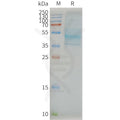 Human CCR7 full length protein-synthetic nanodisc – Figure 1 of 1