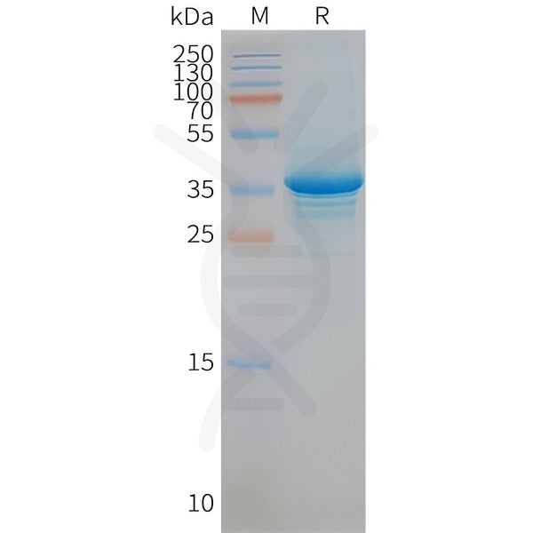 Human STEAP1 full length protein-synthetic nanodisc – Figure 1 of 1