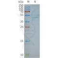 Human CCR3 full length protein-synthetic nanodisc – Figure 1 of 1