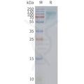 Human SLC2A12 full length protein-synthetic nanodisc – Figure 1 of 1