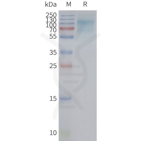Human SLC2A12 full length protein-synthetic nanodisc – Figure 1 of 1