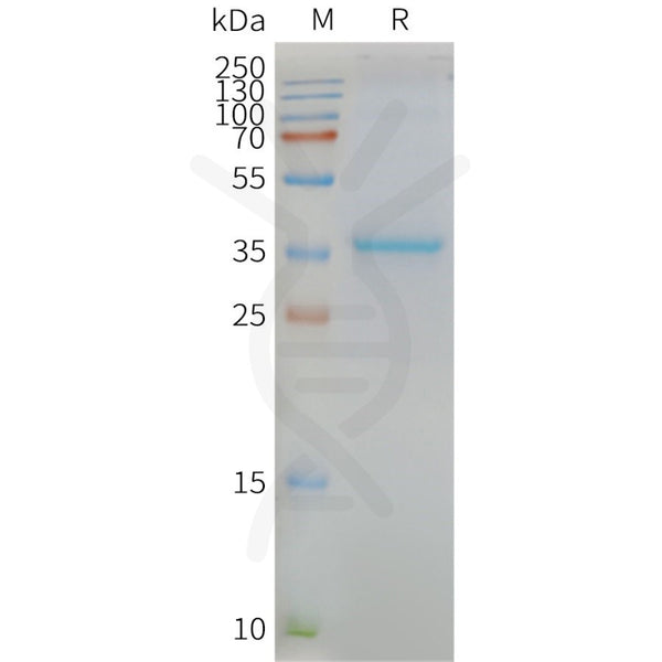 Human MLC1 full length protein-synthetic nanodisc – Figure 1 of 1