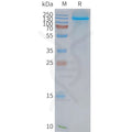 Human NPC1L1 full length protein-synthetic nanodisc – Figure 1 of 1