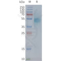 Human CXCR1 full length protein-synthetic nanodisc – Figure 1 of 1